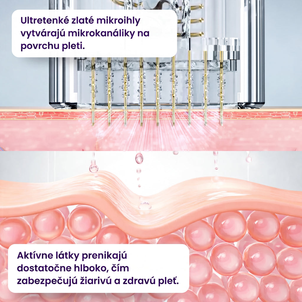 Ever Glo Domáce Ošetrenie Zlatými Mikroihličkami